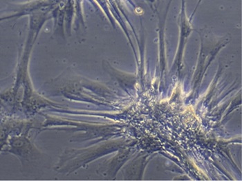 間葉系幹細胞